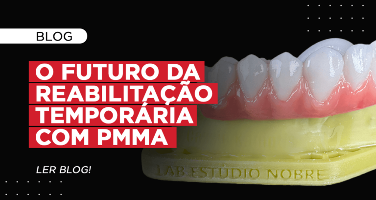 Transitórios em PMMA