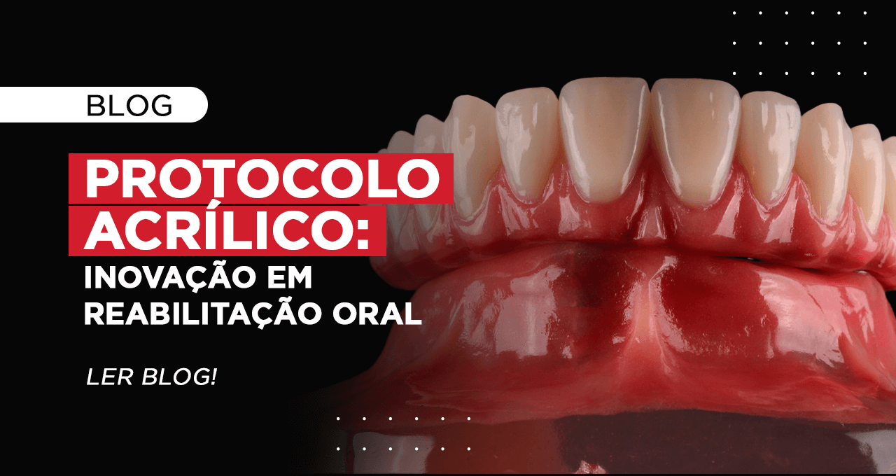 protocolo acrílico estúdio nobre